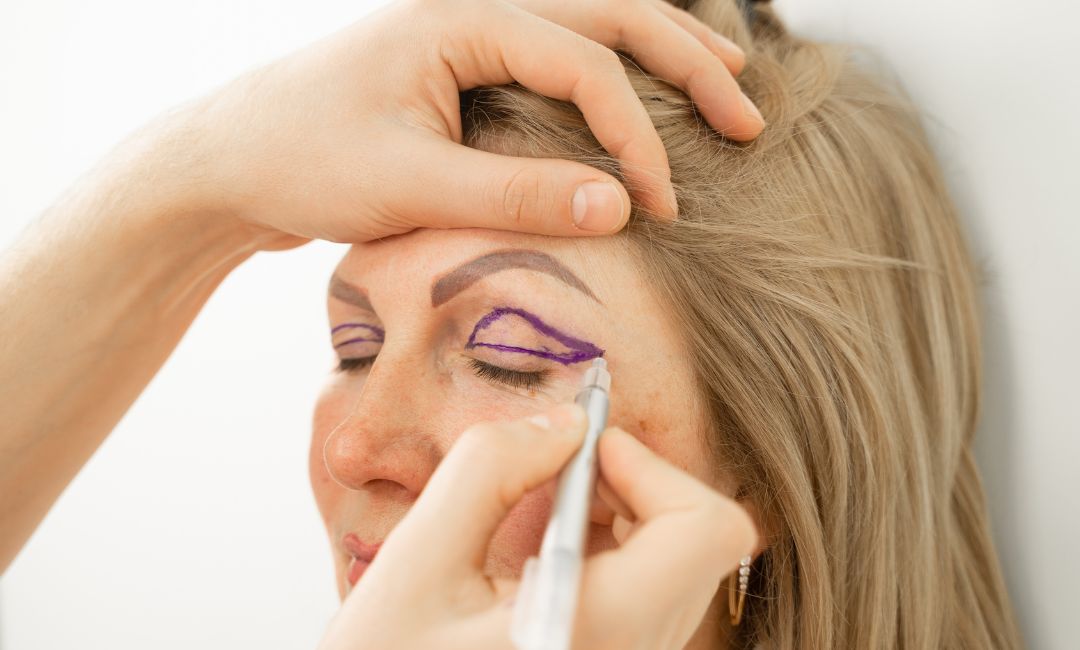 Blefaroplastia em Campinas