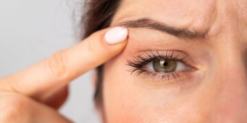 Blefaroplastia: Rejuvenesça seu olhar com a cirurgia nas pálpebras