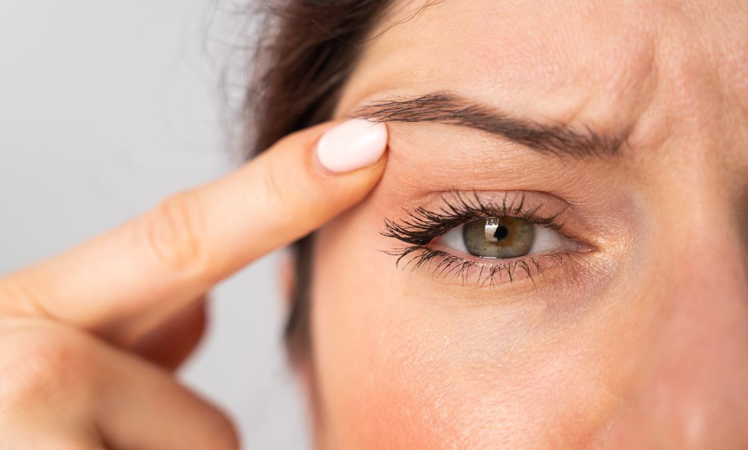 Cirurgia de blefaroplastia em Campinas
