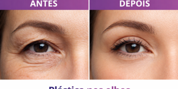 Plástica para os olhos em Campinas