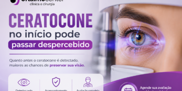 Ceratocone no início pode passar despercebido? Os sinais que muita gente ignora