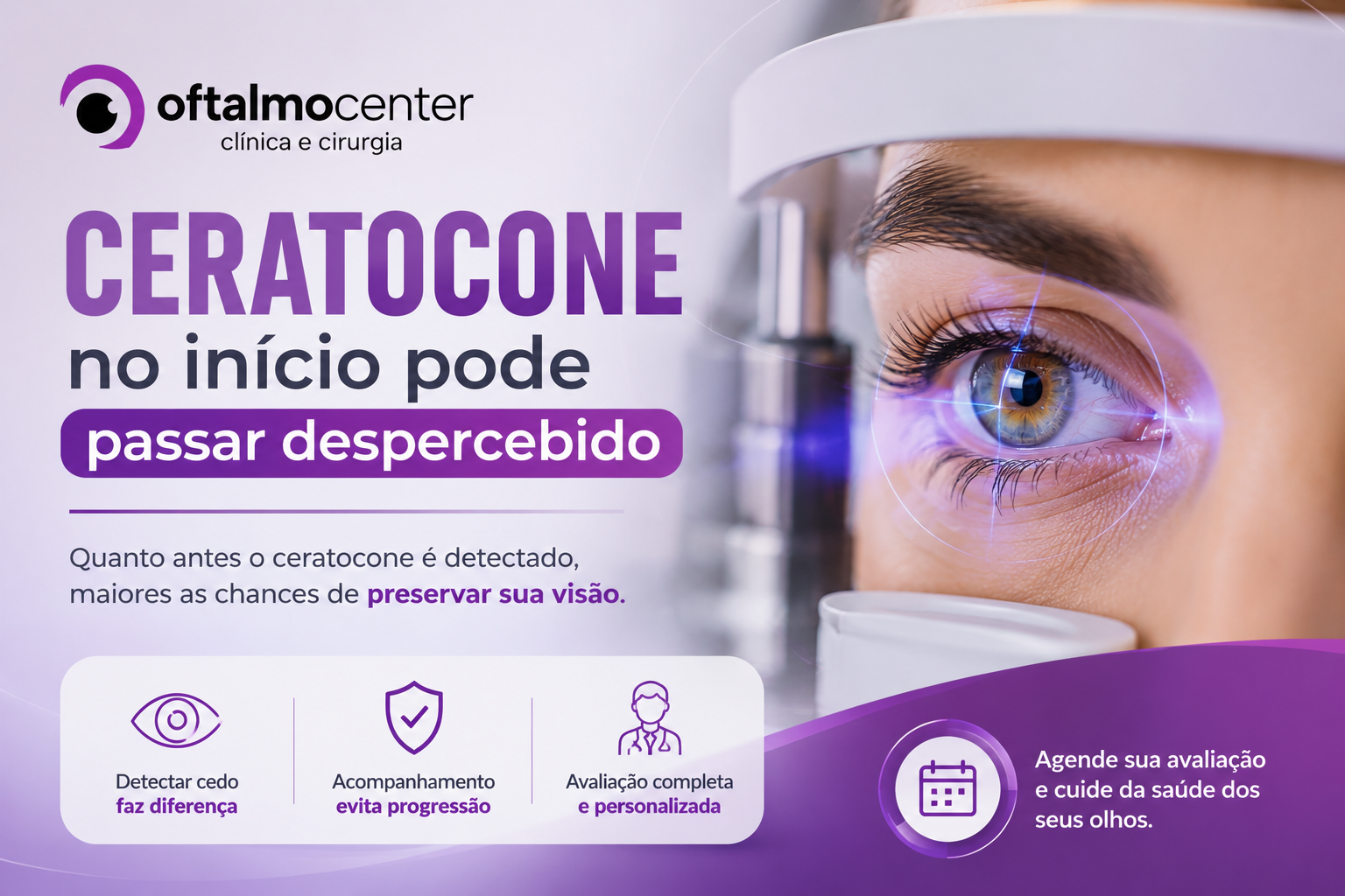 Ceratocone no início pode passar despercebido