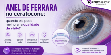 Anel de Ferrara no ceratocone: quando ele pode melhorar a qualidade da visão?