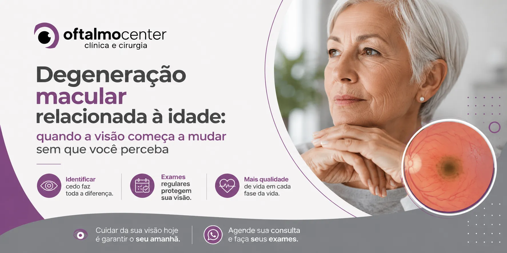 Degeneração Macular Relacionada à Idade: quando a visão começa a mudar sem que você perceba