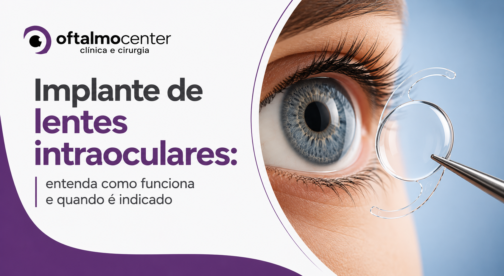 Implante de lentes intraoculares: entenda como funciona e quando é indicado